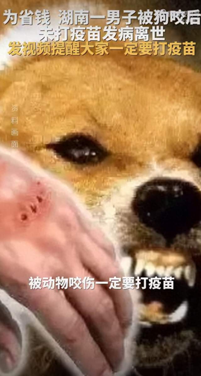 男子被狗咬后为省钱没打疫苗，临终前含泪警告：别拿命开玩笑！