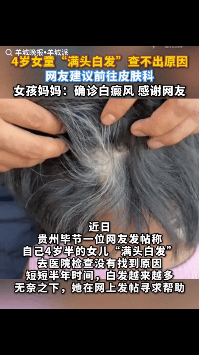 “这就是互联网的意义！”贵州毕节一位四岁半的女童，满头白发，去医院也没查出原因，
