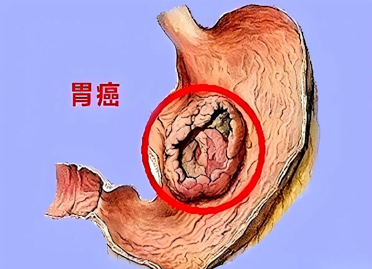 这两天，河南一位52岁女大夫的消息，让不少人后背直冒凉风。一个在医院里干了半辈子