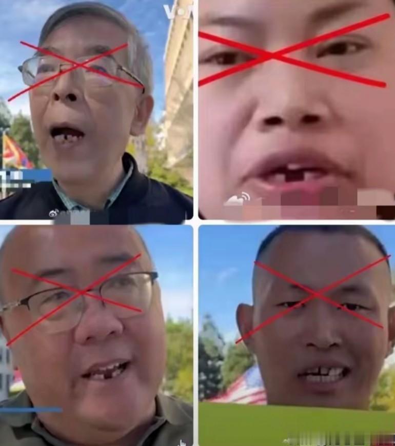 这四位润到米国去的名人。
都同样掉了牙齿，为什么呢？
美国看牙医太贵了，根本去不