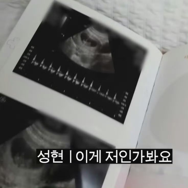 CORTIS严成玹公开儿时旧照，萌萌的