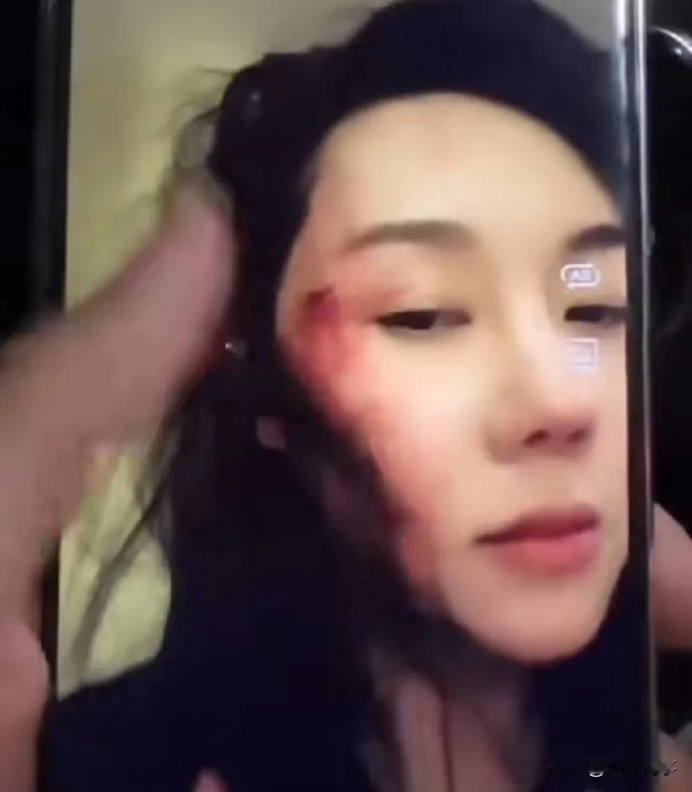 “赵四”儿子刘程人设塌房，晒伤怒揭家暴行为，动Dao威x、辱M丈母娘。

   