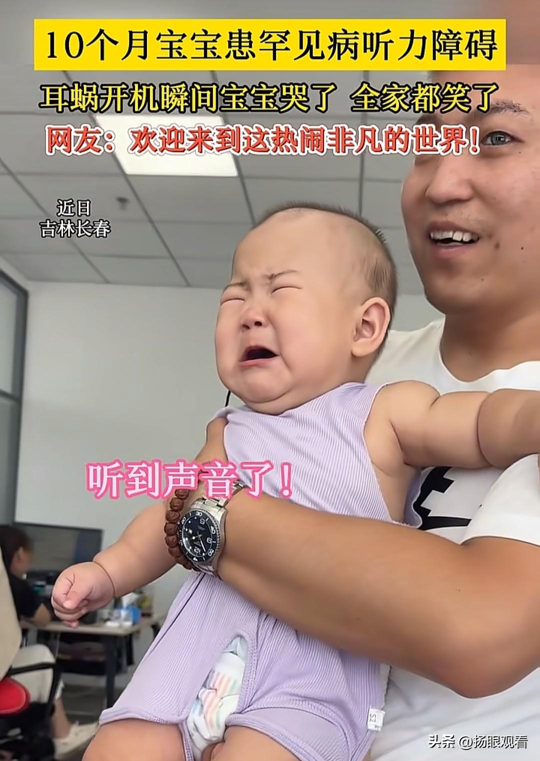 吉林长春这个画面看得人瞬间破防！近日，吉林长春10个月宝宝患罕见病听力障碍，耳蜗