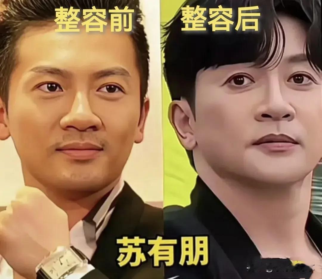 没想到苏有朋也整容过。
没想到陈浩民也整容过。
没想到吴刚也整容过。
没想到刘恺