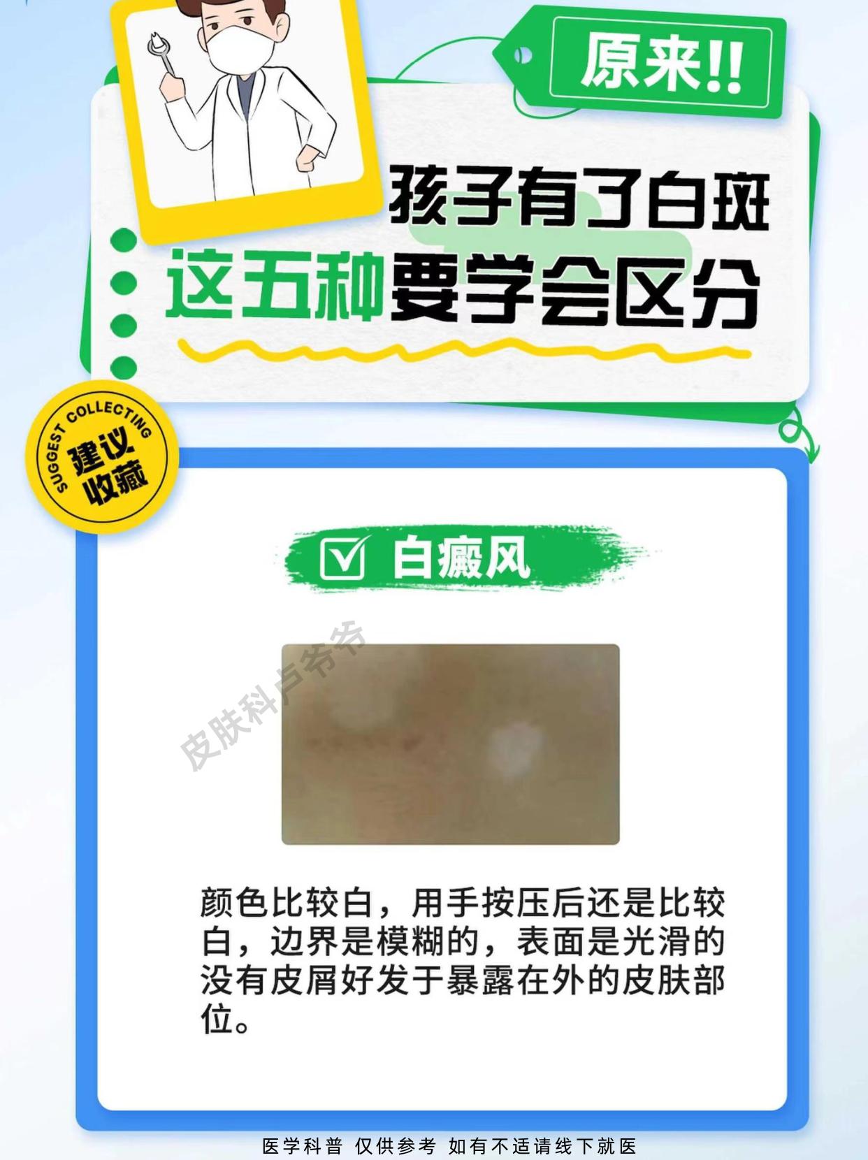 白斑分辨，你学会了吗？医学科普