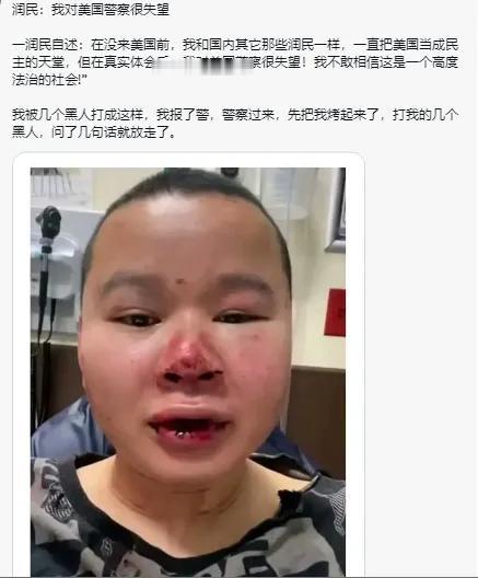 无良润人吃了民主铁拳，心理觉得很委屈，还要跑到网上发发牢骚。[看]