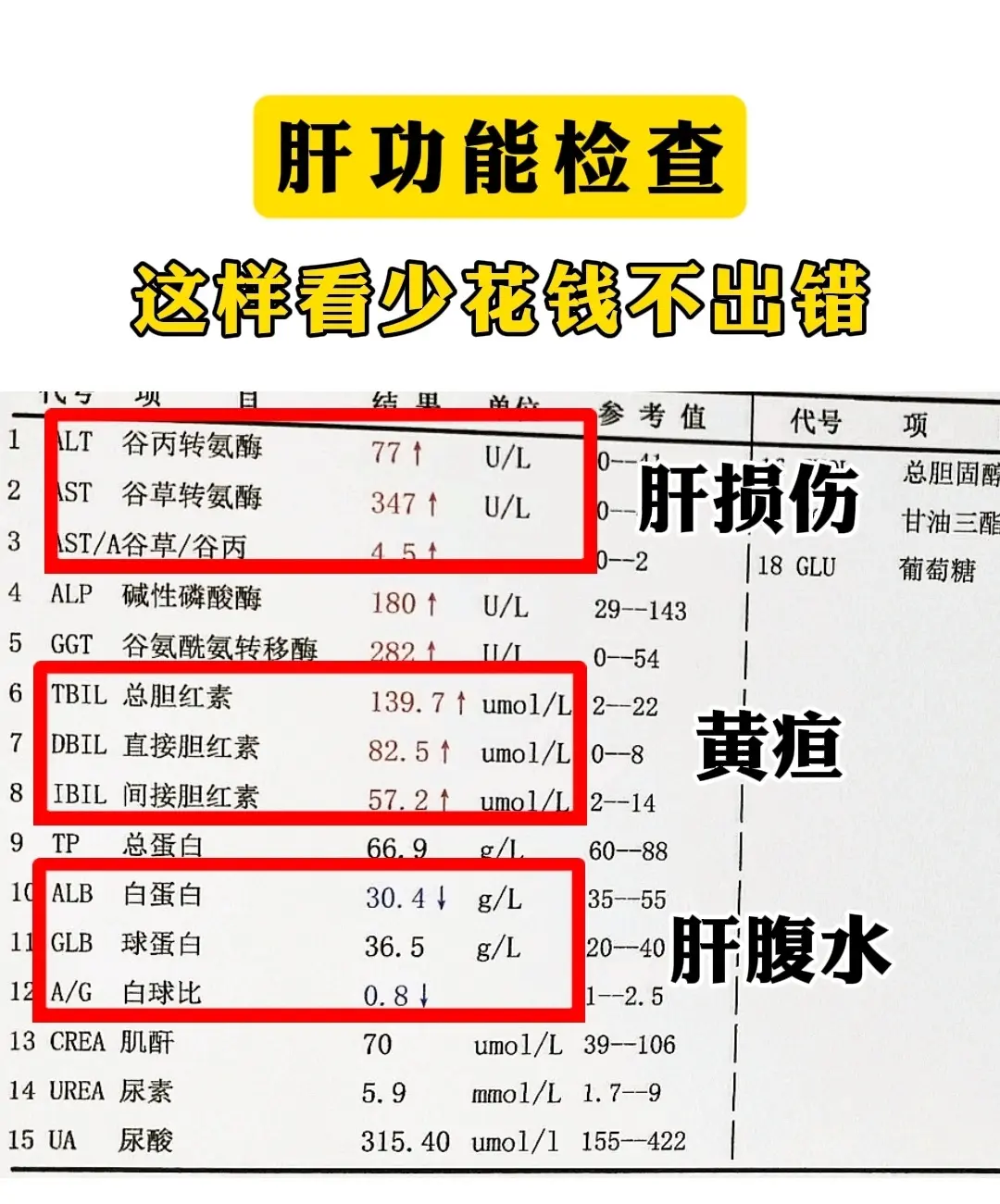 干货分享 肝硬化  肝功能 山东知道