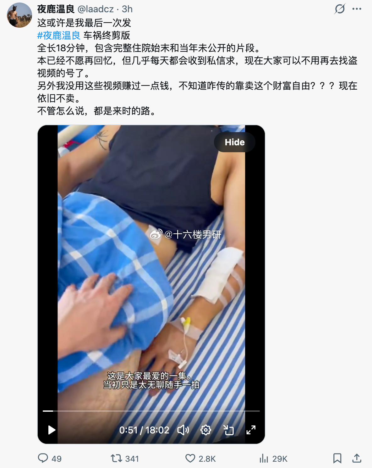 夜鹿温良，车祸终剪版 全长18分钟，包含完整住院始末和当年未公开的片段友友们开车