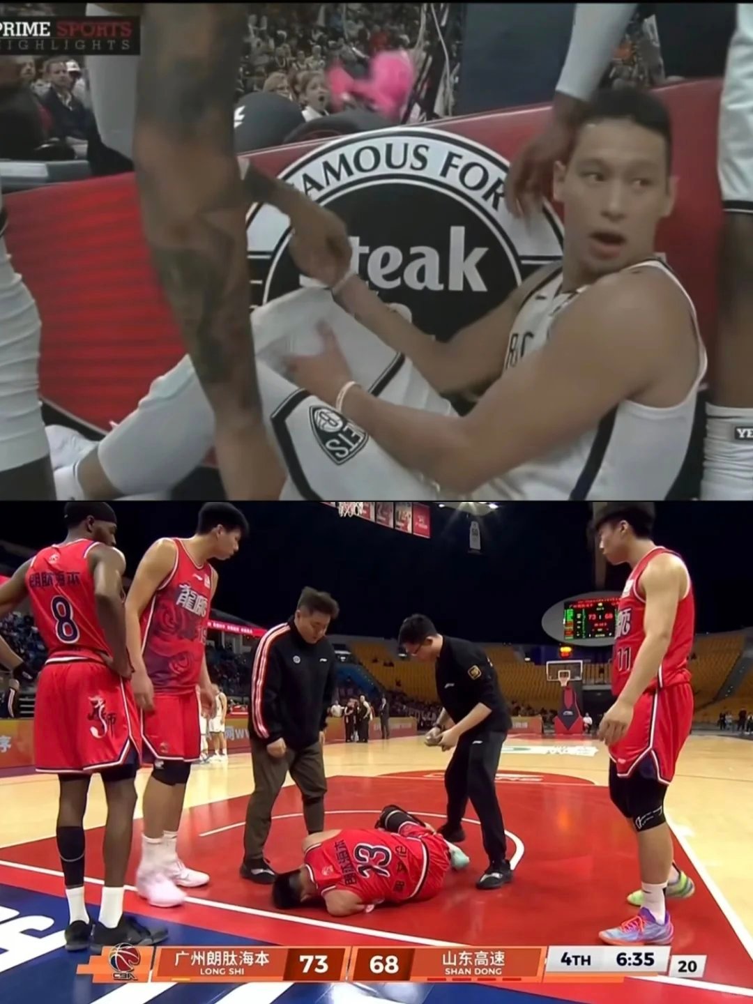 郭艾伦受伤0可能是前叉韧带，如果真的前叉断裂，或许应该和艾伦说再见了 