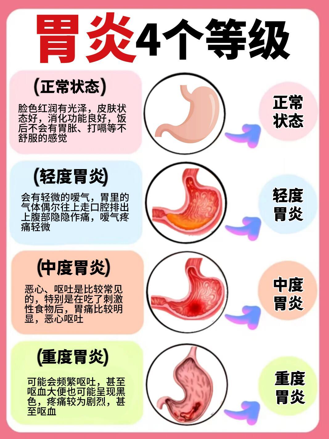 引起胃炎的原因，别再傻傻不知道了！ 