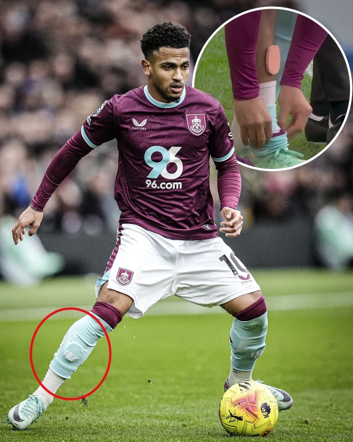 伯恩利前锋马库斯·爱德华兹的护腿板可能是你见过最小的护腿板