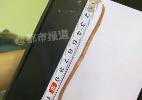 “悲剧还是发生了！”河南郑州，一11岁男孩突然开始暴瘦，体重只有可怜的15公斤！