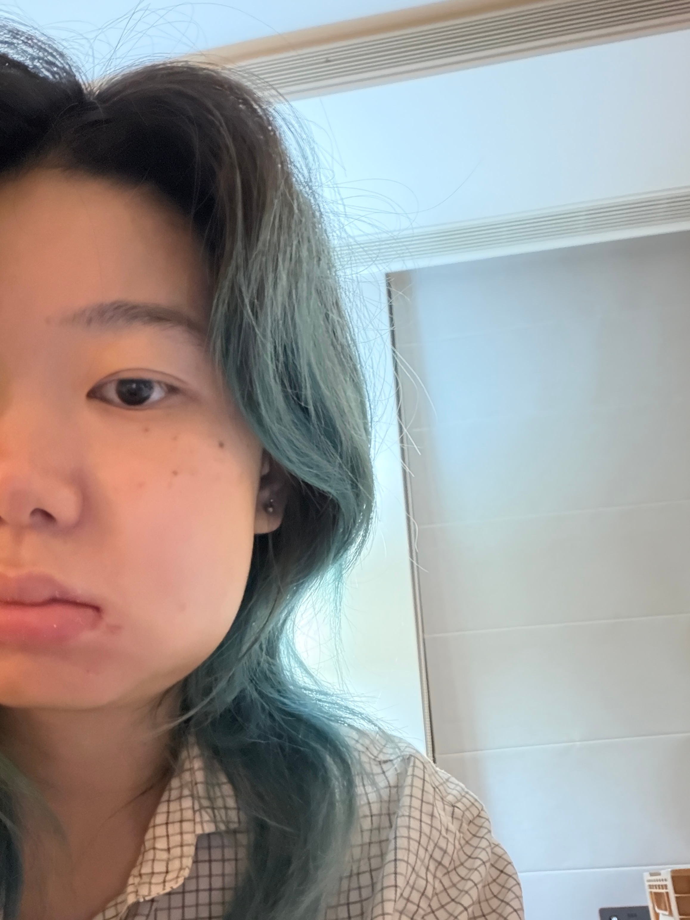 这次拔牙有点伤到我了😢 