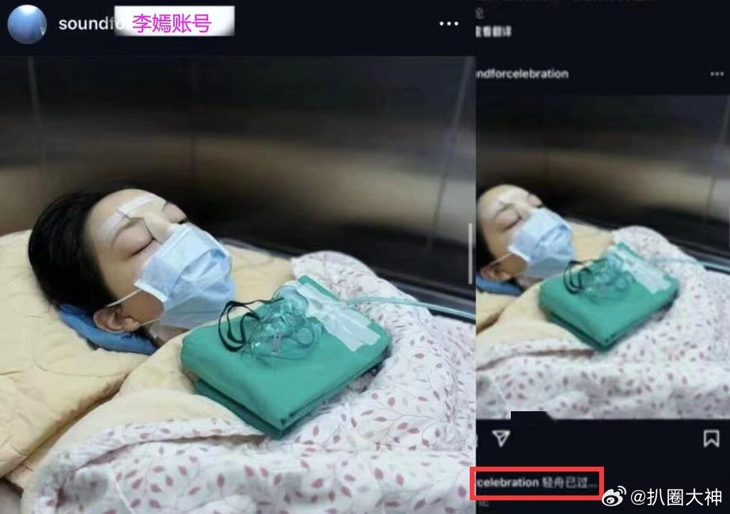 #王菲女儿李嫣再次做唇腭裂手术#听过很多小朋友因为王菲成立的嫣然天使基金会得到了