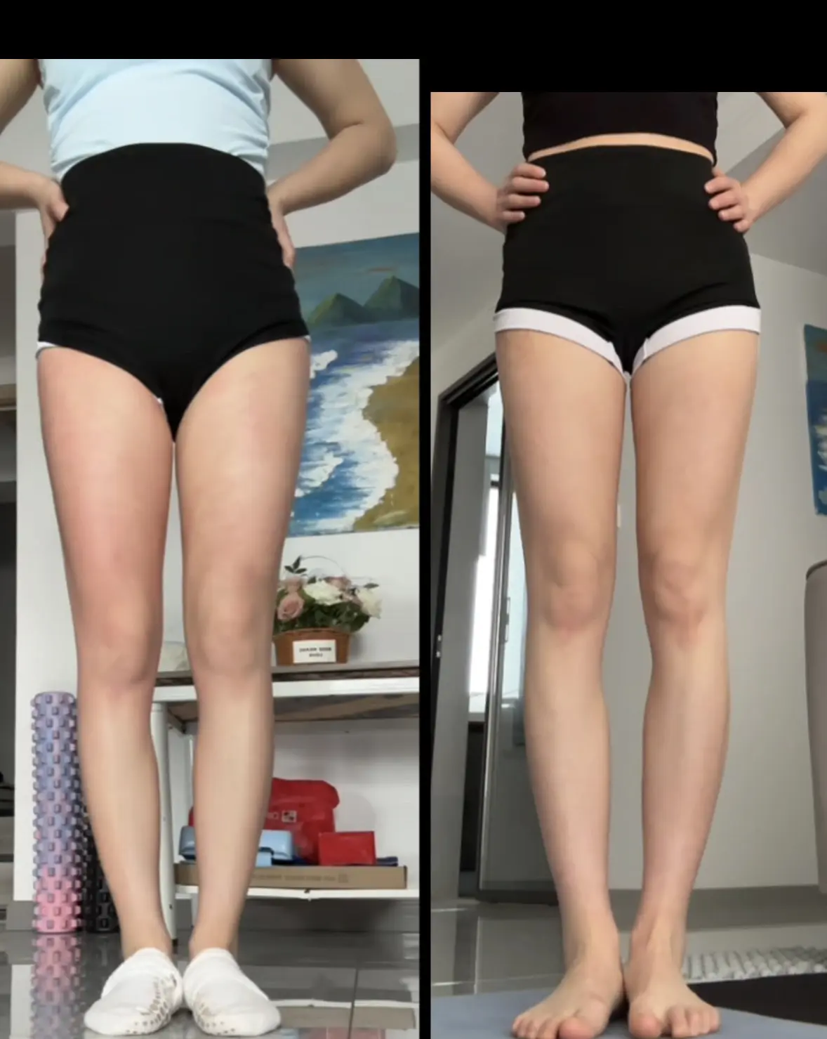 腿还是我的腿 只是腿上肉肉薄了一些。