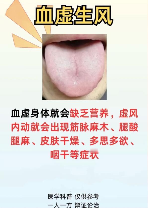 舌头上的健康信号：气虚生湿、血虚生风怎么看