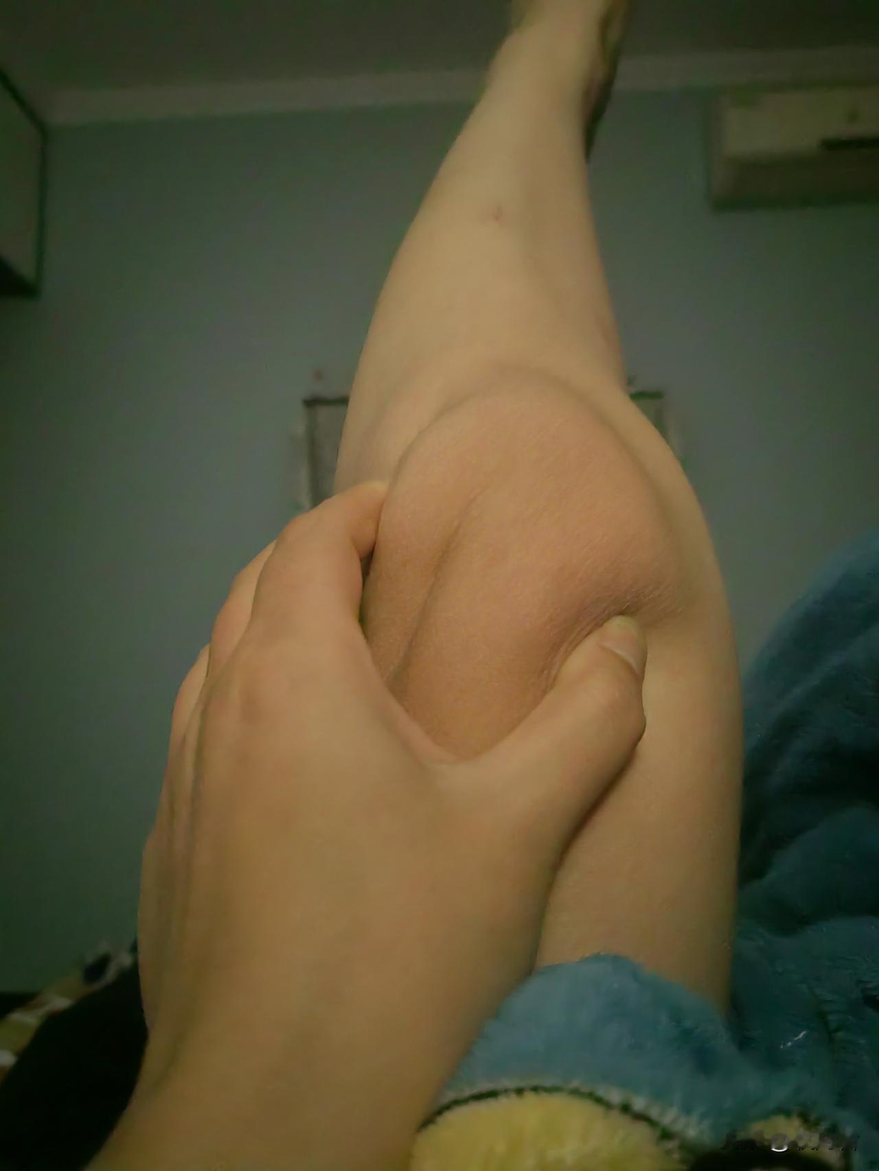 我是安徽的
安徽蚌埠的
膝盖叫割了败子
膝盖