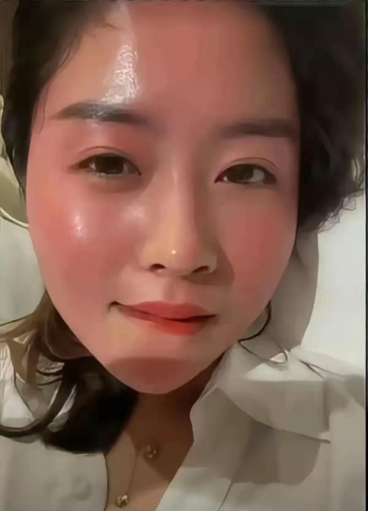 喝点就上脸是什么体质