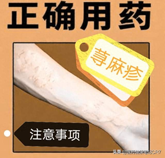 风热选消风，风寒选荆防，血虚选润燥等（7种荨麻疹中成药）