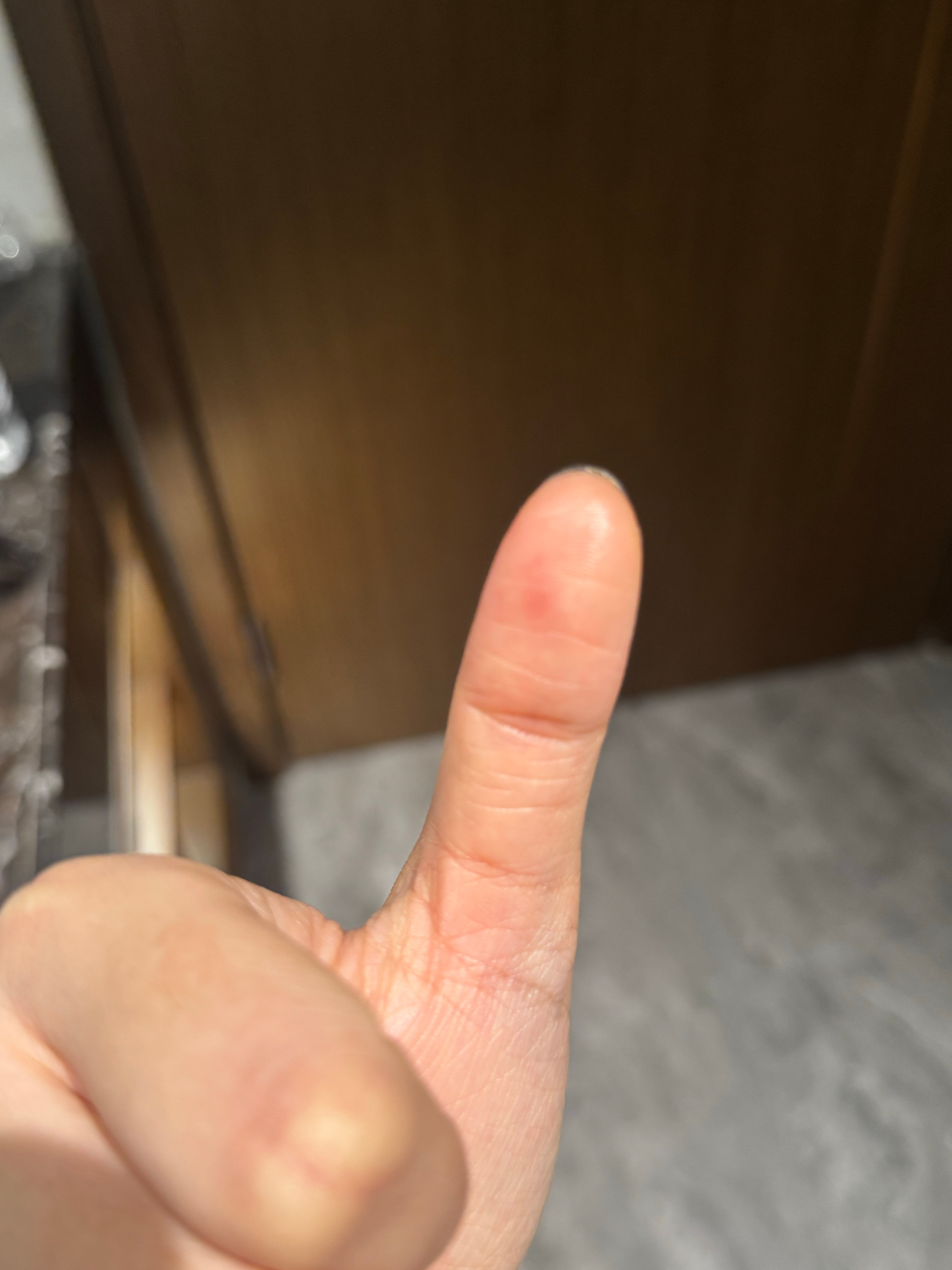 我昨天吃臭豆腐不小心把签子的小木刺刺进去了，有什么办法把他弄出来吗 ​​​