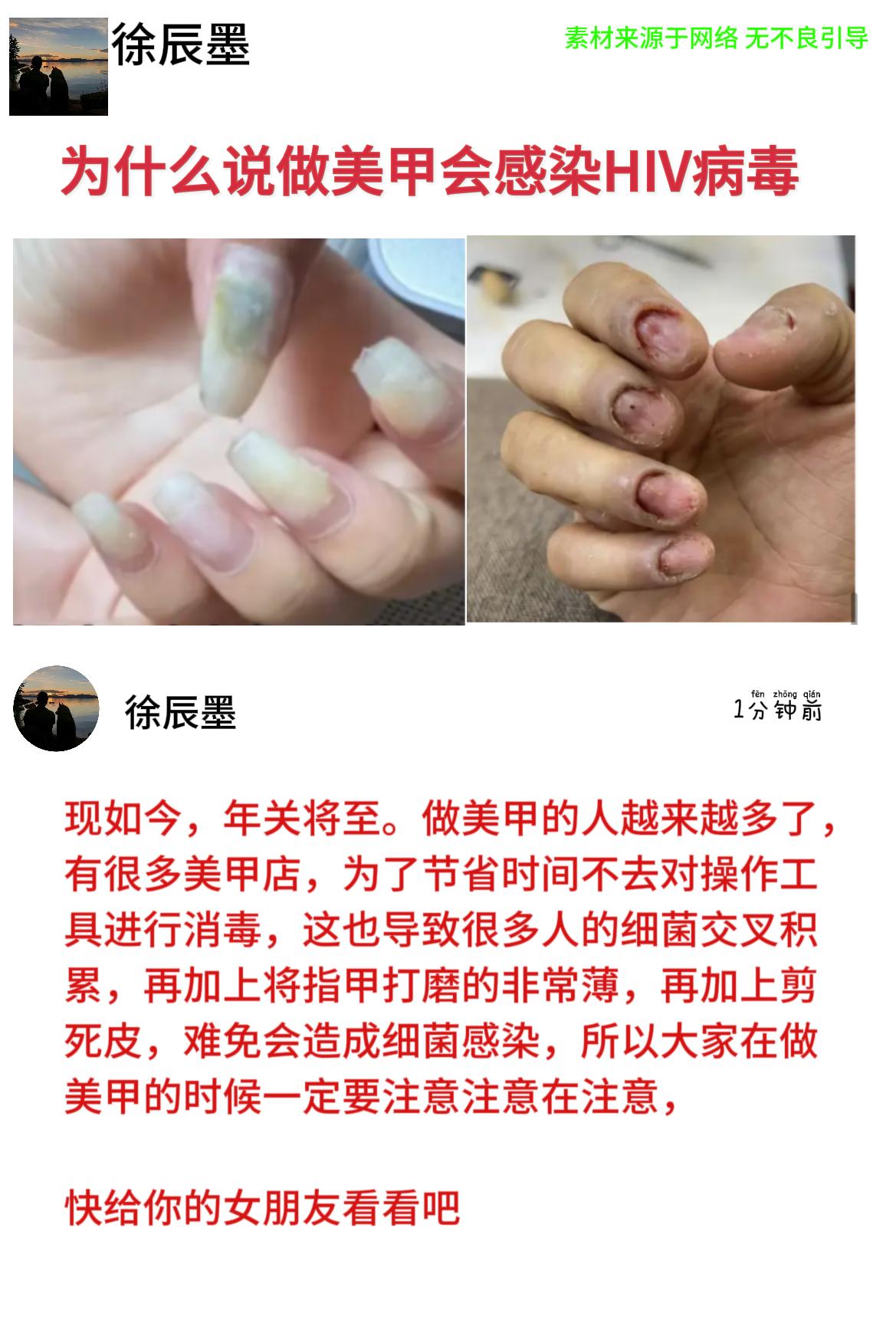 美甲 内容启发搜索 社会百态 hiv病毒