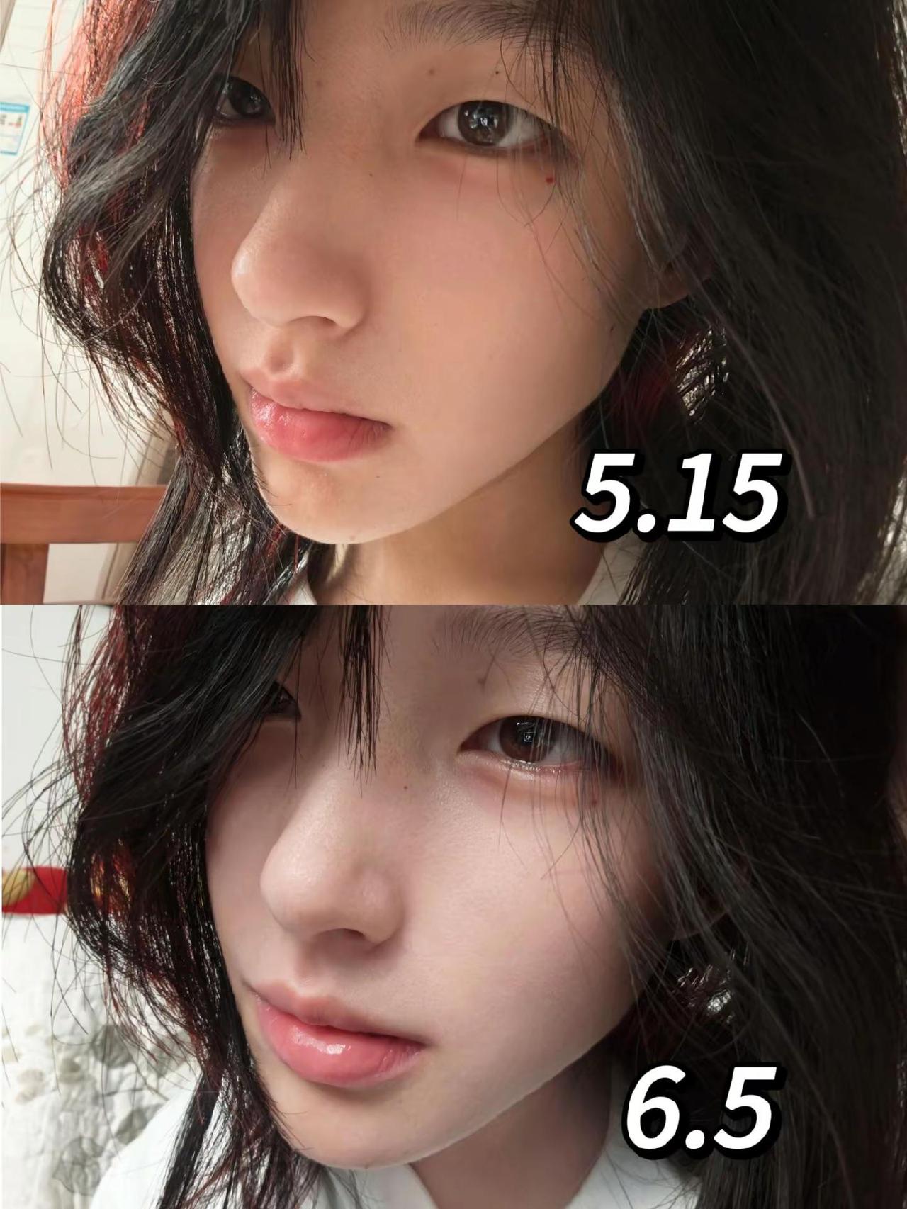 白白嫩嫩就是我所憧憬的未来美肤面罩仪