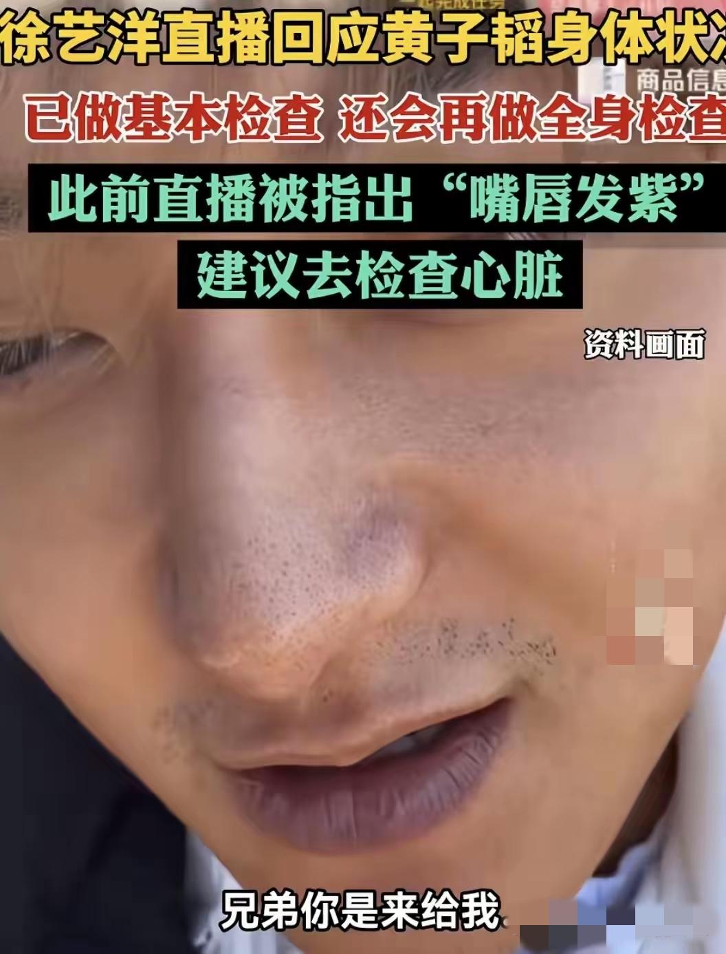 黄子韬嘴唇紫的可怕，让一众网友担心不已，纷纷让他去查心脏。
他嘴唇的模样像极了刚
