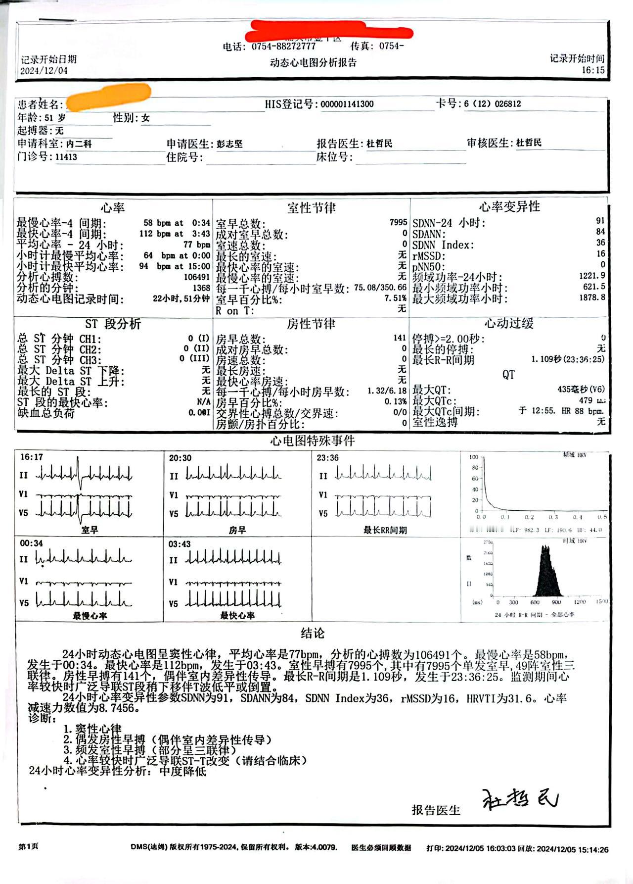 53岁女子心脏一天乱跳近8000次，折腾一年多，元凶竟是我们最忽视的它！

你敢