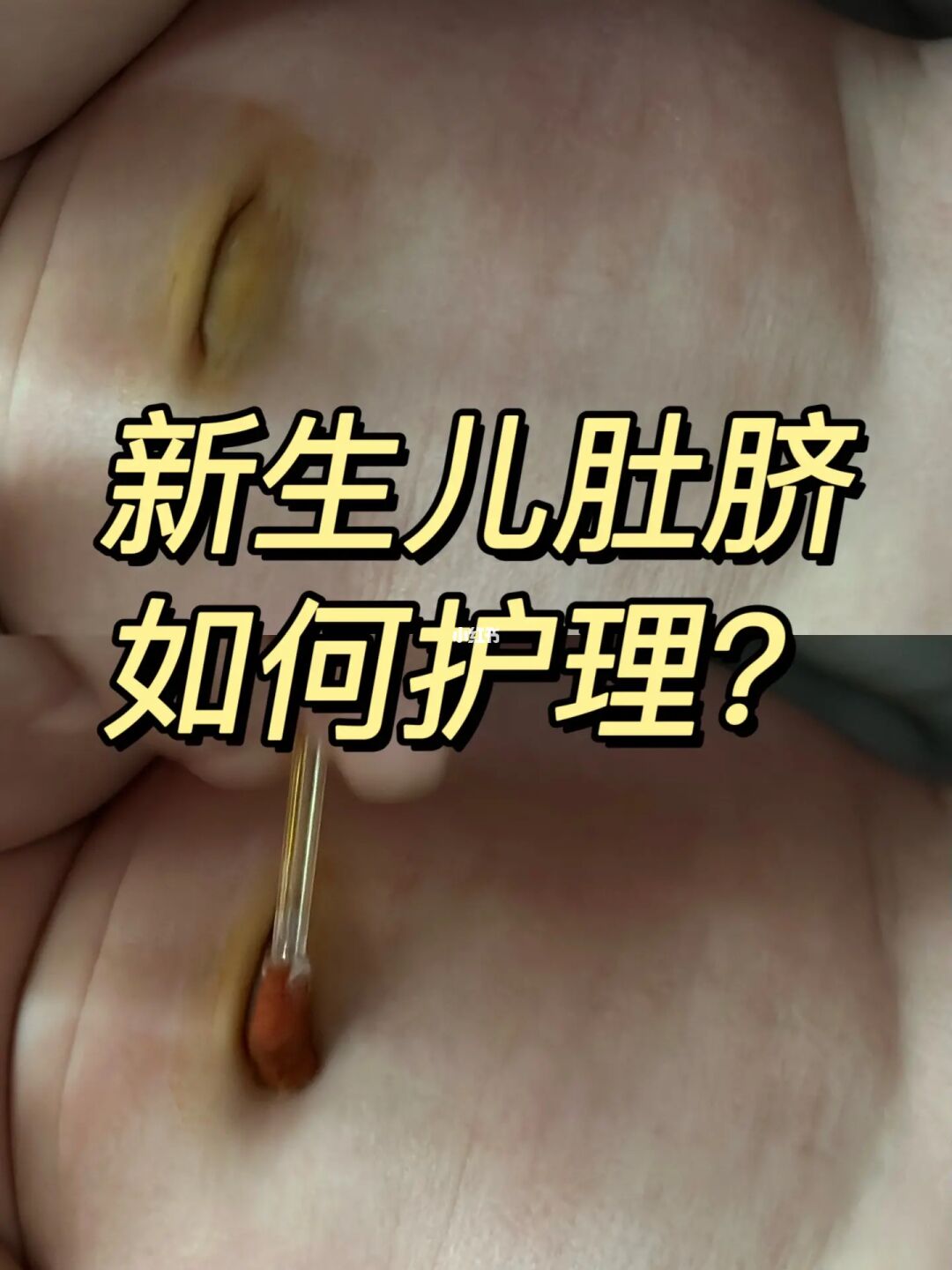 新生儿肚脐如何护理？