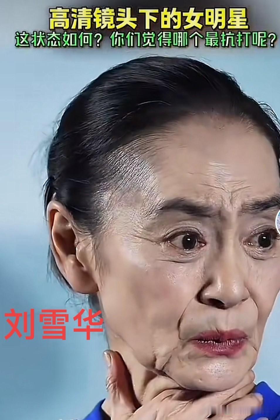 天呐！原来明星也不是不老女神，岁月不饶人，而且是不饶任何人，明星也一样。

刘雪