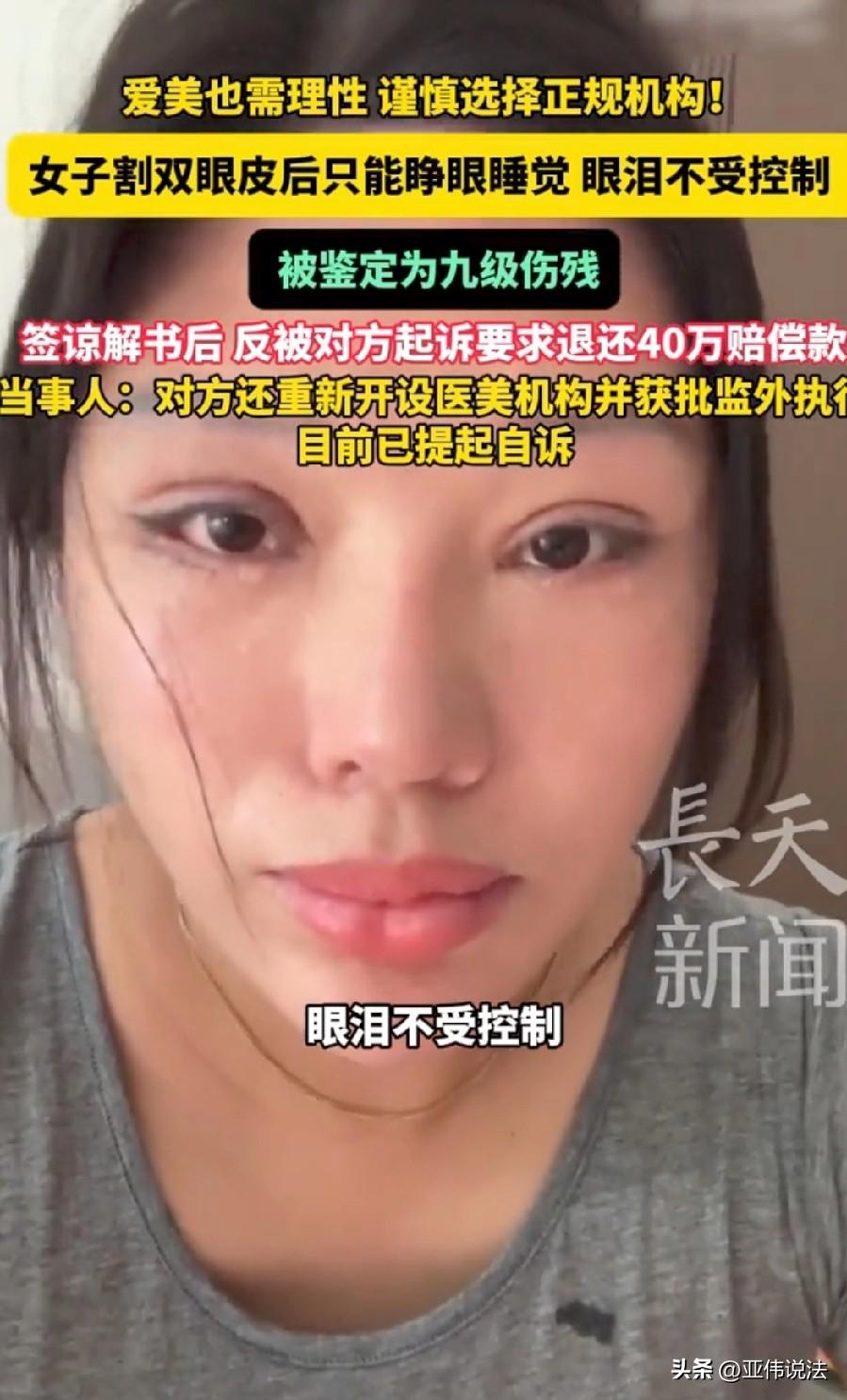 江苏苏州，女子在老乡的忽悠下，到一家整形医院割双眼皮，谁知，手术当晚眼压就高的吓
