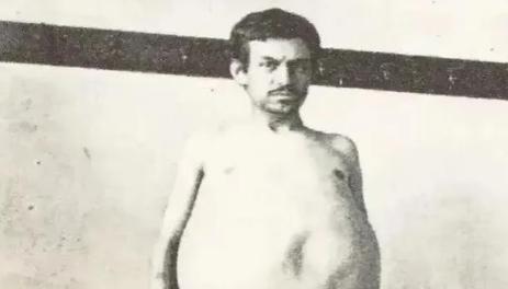 1940 年，美国一男子正在排泄大便时意外猝死，法医尸检震惊众人，体内竟囤积 3