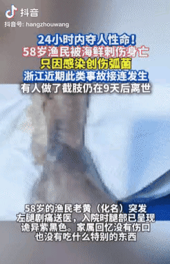 悲剧还是发生了！浙江温州这事儿，看完后背直冒冷汗——一个老渔民被海鲜刺伤，没当回