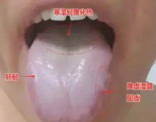 针对此类舌象，脾虚再重也莫乱用药！
有人觉得自己畏寒怕冷、手脚冰凉，一吃凉食就拉