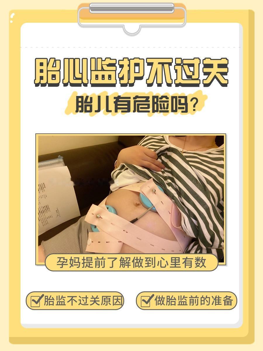 [左上]胎心监护不过关胎儿有危险吗？孕妈要懂

🤰 到了怀孕的后期，产检会比较
