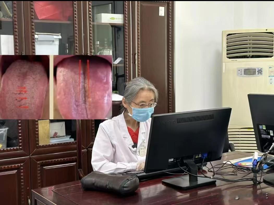 舌头有裂纹，竖裂纹代表痛，横裂纹代表胀,你是属于哪种情况呢?

先来看竖裂纹。
