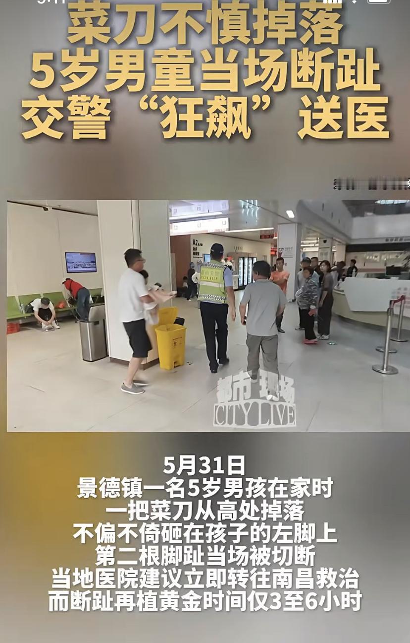 揪心!5岁男孩脚趾被菜刀砍断，南昌交警这个操作太燃了
5月31日，江西景德镇一个