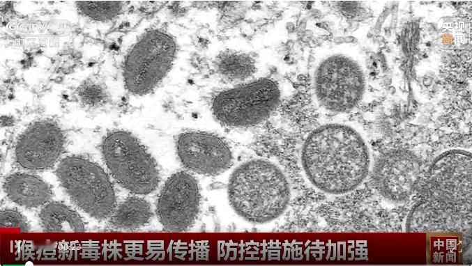 犹撒生物战，传染病的流感化！

猴痘病毒在犹撒的改造下，已经成功摆脱通过直接接触