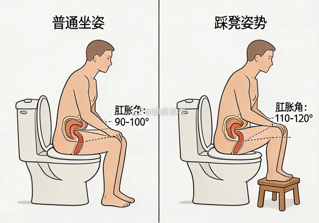 拉屎姿势 