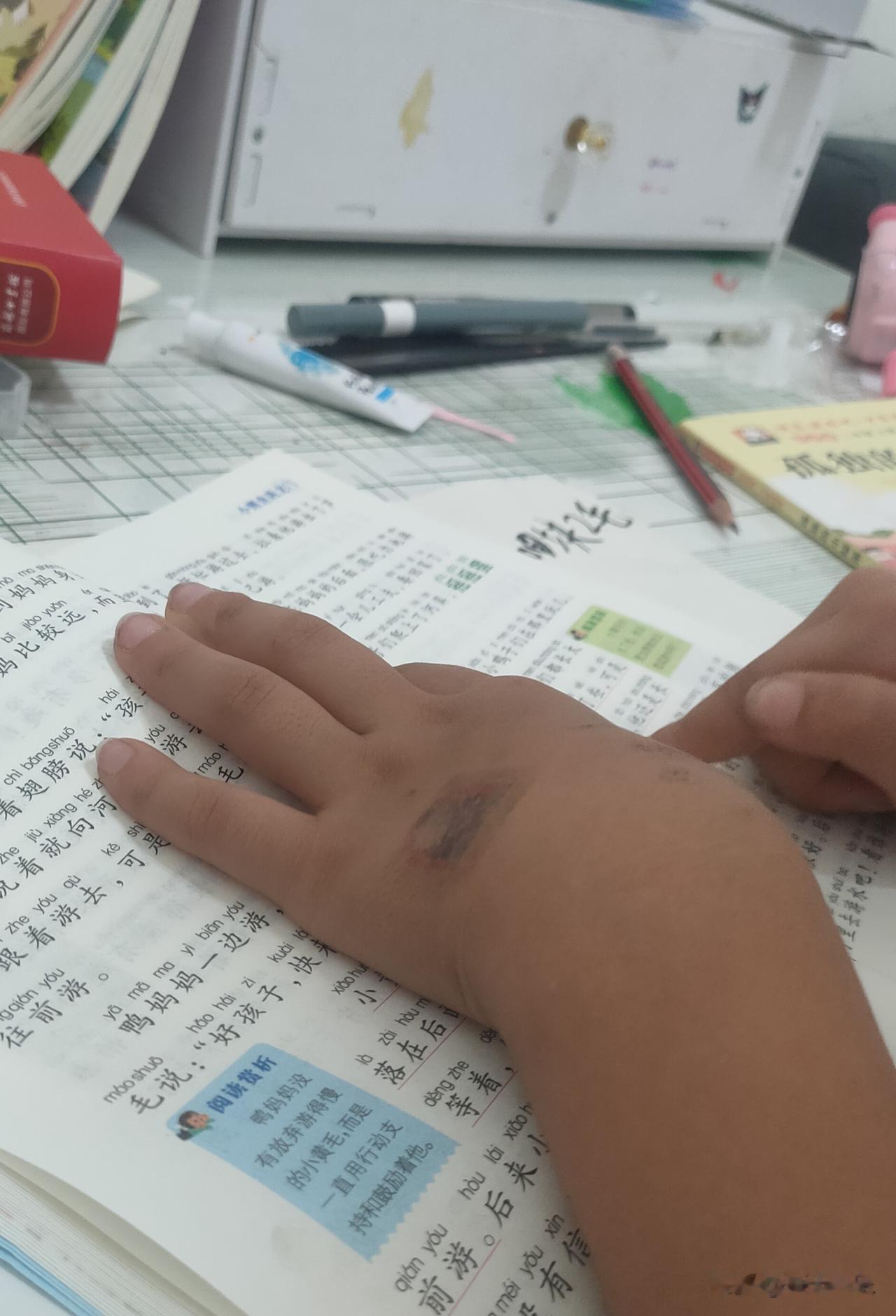 每一个童年的手背上，
都有“纹身”吗？[捂脸]