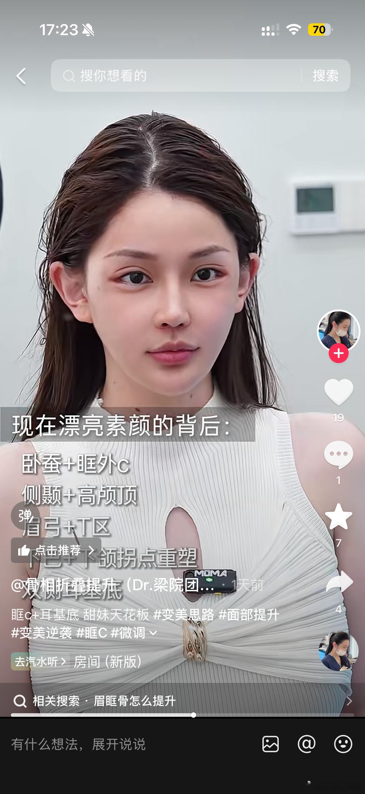 到底是谁在喜欢这种金字塔三角形头型头顶一个尖尖+颞区死劲填再把耳朵拉宽妥妥的🐭