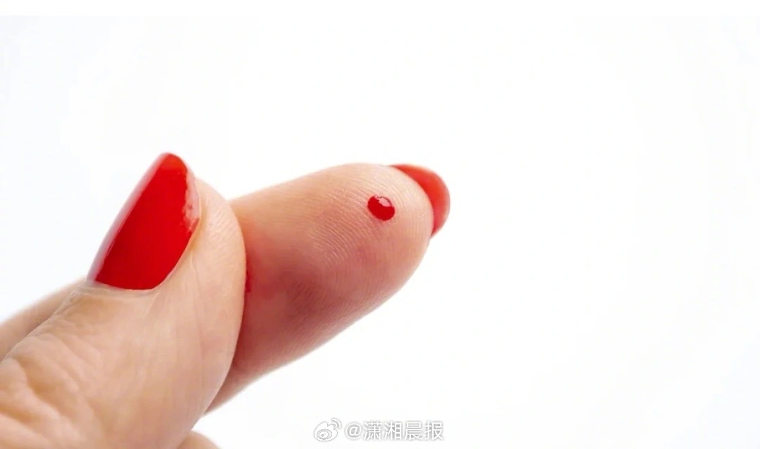 【#科学家发现新血型仅一人拥有#】多数人熟知人类有四大基础血型——A型、B型、A