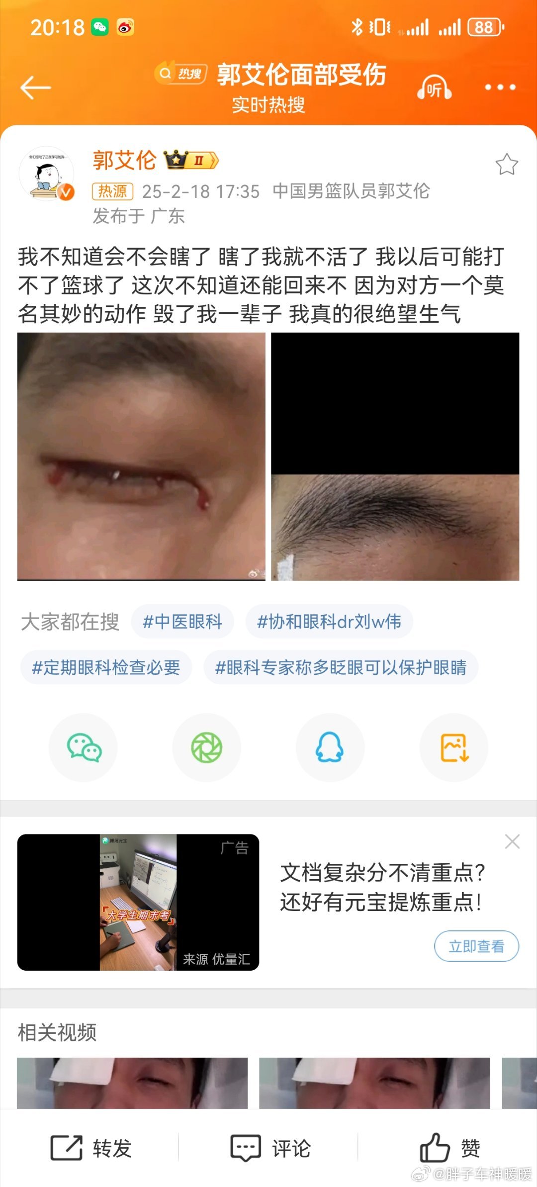 郭艾伦 以后可能打不了篮球了 怎么能发生这种意外？？想不到啊，还得郭艾伦这种明星