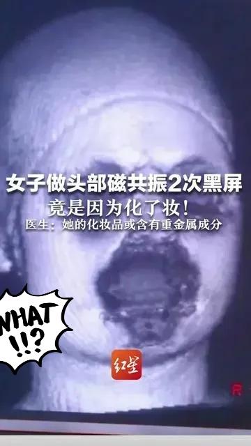 杭州女子做核磁两次黑屏，
罪魁祸首竟是脸上的眼影粉底？
这事看着离谱，实则暴露了