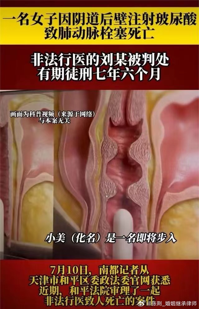 #女子私密处手术后死亡1人获刑##律师说法#我还是那个观点，女孩子谨慎做医美项目