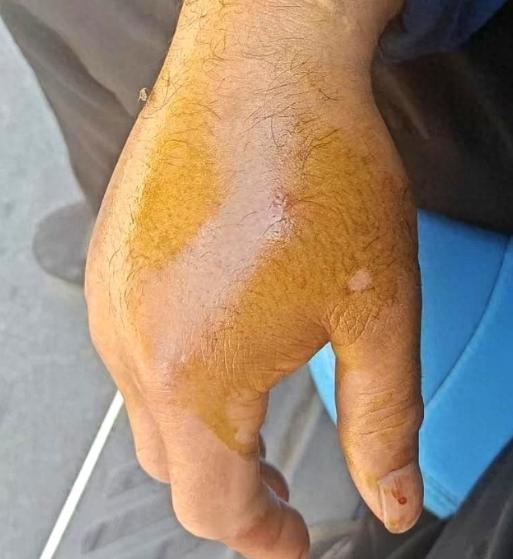 这大叔心是真大！一锄头斩断2米长的眼镜王蛇，甩甩泥巴像没事人一样接着干活。可他压