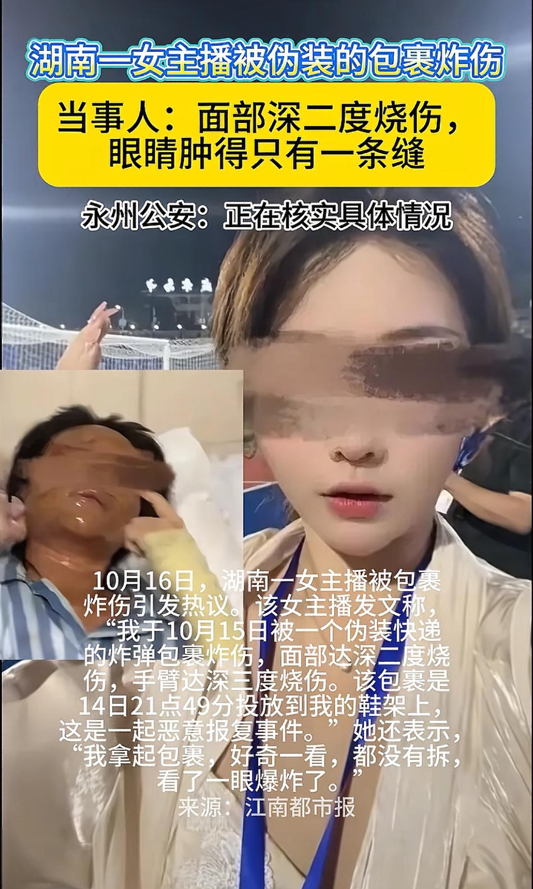 湖南一女主播被伪装的包裹炸伤。 当事人：面部深二度烧伤，眼睛肿得只有一条缝，永州