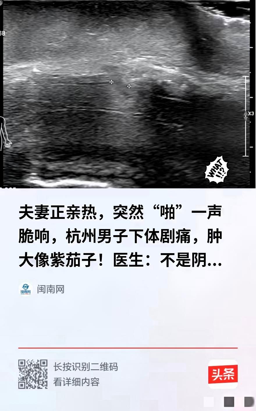 光是看描述都觉得揪心，杭州这位49岁男子的经历，也给不少夫妻敲了个警钟。夫妻亲密