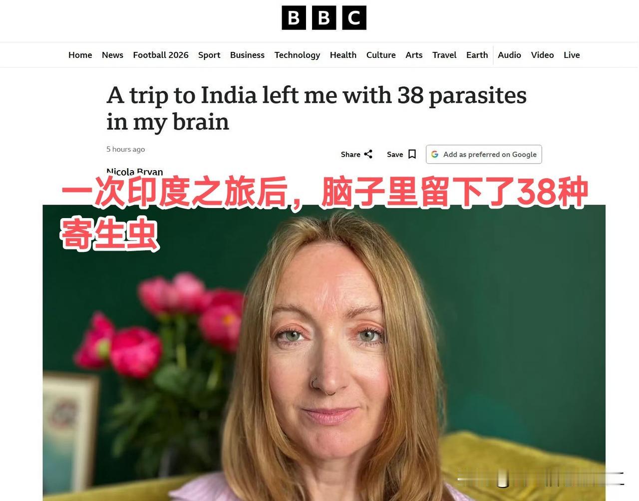 英国媒体，英国女子一次印度之旅后，脑子里留下了38种寄生虫！