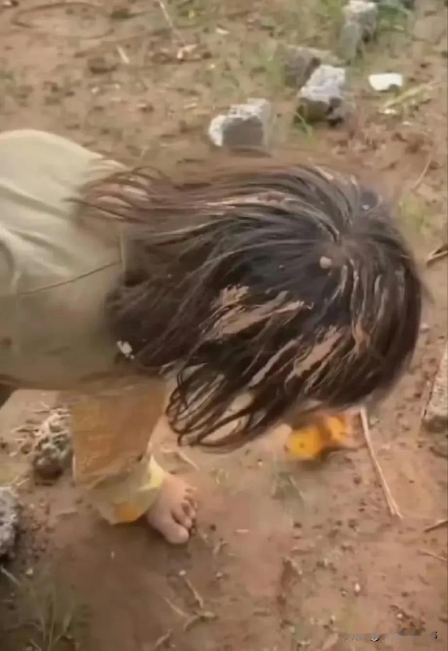 加沙，饥饿的小女孩。[伤心]